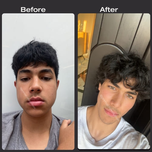 15